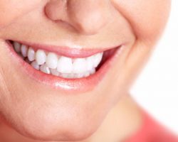 teeth_whitening_1 Alma, MI Dentist | Mid-Michigan Dental Excellence